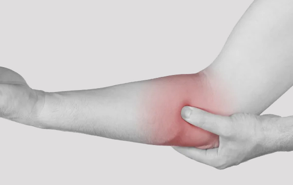 Medial Epicondylopathy