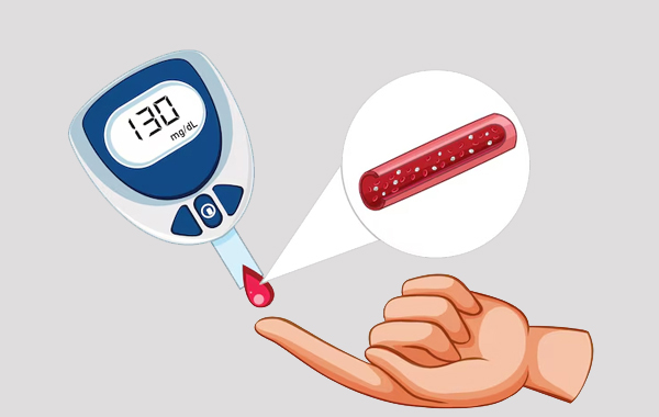 Diabetes Mellitus