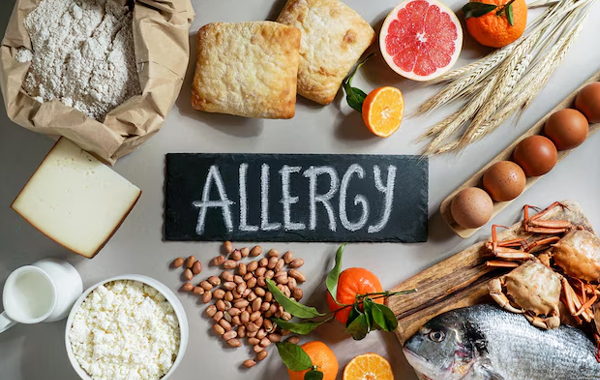 Food Allergies